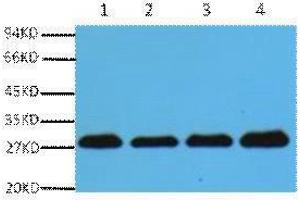 Western Blotting (WB) image for anti-Proliferating Cell Nuclear Antigen (PCNA) antibody (ABIN3181103) (PCNA 抗体)
