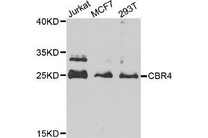 Western blot analysis of extracts of various cell lines, using CBR4 antibody (ABIN5972931) at 1/1000 dilution. (CBR4 抗体)