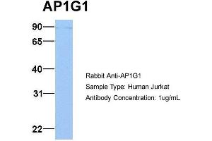 Host: Rabbit Target Name: AP1G1 Sample Type: Jurkat Antibody Dilution: 1. (gamma 1 Adaptin 抗体  (C-Term))