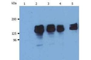 Western Blotting (WB) image for anti-Inositol Polyphosphate-5-Phosphatase, 145kDa (INPP5D) (N-Term) antibody (ABIN238500) (INPP5D 抗体  (N-Term))