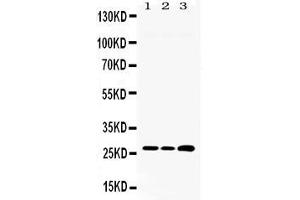 Western blot analysis of RPL19 expression in rat liver extract ( Lane 1) HEPA whole cell lysates ( Lane 2) and HEPG2 whole cell lysates ( Lane 3). (RPL19 抗体  (C-Term))