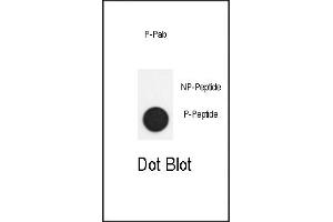 Dot blot analysis of anti-Phospho-SD2- Antibody (ABIN390037 and ABIN2839786) on nitrocellulose membrane.