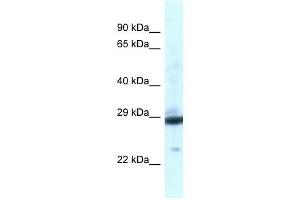 Western Blot showing PGAM1 antibody used at a concentration of 1 ug/ml against Fetal Liver Lysate (PGAM1 抗体  (C-Term))