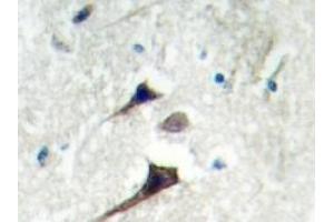 Image no. 1 for anti-14-3-3 epsilon (YWHAE) antibody (ABIN272265) (YWHAE 抗体)