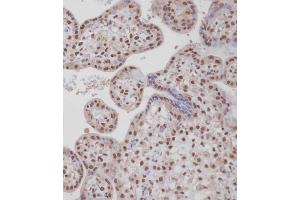 Immunohistochemical analysis of A on paraffin-embedded Human placenta tissue. (TARDBP 抗体  (N-Term))