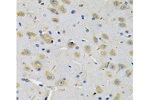 Immunohistochemistry of paraffin-embedded Rat brain using RRAGC Polyclonal Antibody at dilution of 1:100 (40x lens). (GTR2 抗体)