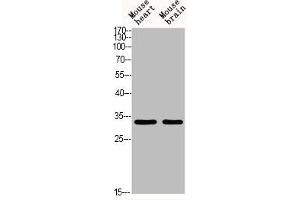 Western blot analysis of MOUSE-HEART MOUSE-BRAIN using Acetyl-TAL1/2 (K221/K222/K36/K37) antibody.