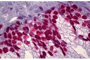 Anti-DNA ds antibody IHC staining of human prostate. (dsDNA 抗体)