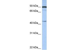WB Suggested Anti-PSMD6 Antibody Titration:  0.