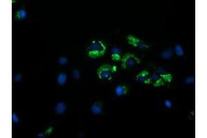 Image no. 3 for anti-Golgin, RAB6-Interacting (GORAB) (AA 35-394) antibody (ABIN1491439) (GORAB 抗体  (AA 35-394))