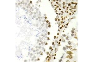 Immunohistochemistry of paraffin-embedded rat testis using NFKB2 antibody at dilution of 1:200 (400x lens). (NFKB2 抗体)