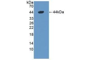 Detection of Recombinant DEFa1, Mouse using Polyclonal Antibody to Defensin Alpha 1, Neutrophil (DEFa1) (alpha Defensin 1 抗体  (AA 20-93))