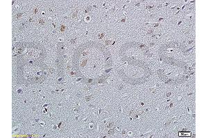 Formalin-fixed and paraffin embedded rat brain labeled with Anti P45017A1/Cytochrome P450 17A1 Polyclonal Antibody, Unconjugated (ABIN720445) at 1:200 followed by conjugation to the secondary antibody and DAB staining (GANAB 抗体  (AA 428-540))