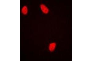 Immunofluorescent analysis of NUDC staining in HepG2 cells. (NUDC 抗体)