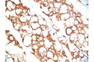 Mouse visceral white fat tissue was stained by Rabbit Anti-Vaspin (386-414) (Human) Serum (SERPINA12 抗体  (AA 386-414))