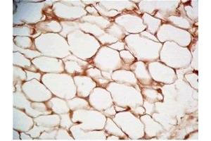 Rat visceral fat tissue was stained by Rabbit Anti-Cathepsin S (298-331) (Human) Serum (Cathepsin S 抗体  (AA 298-331))