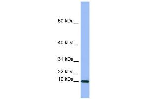WB Suggested Anti-SEMG1  Antibody Titration: 0. (SEMG1 抗体  (Middle Region))