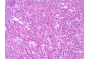 Anti-IIL-22 antibody IHC of human tonsil. (IL-22 抗体)