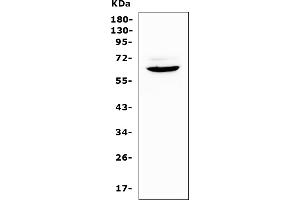 anti-Heparanase (HPSE) (AA 206-457) antibody