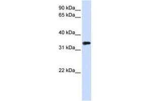 Image no. 1 for anti-Methyl-CpG Binding Domain Protein 3 (MBD3) (AA 72-121) antibody (ABIN6740655) (MBD3 抗体  (AA 72-121))