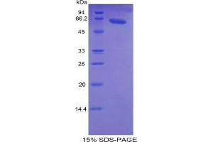SDS-PAGE analysis of Human TNNC2 Protein.