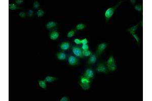 Immunofluorescence staining of Hela cells with ABIN7145079 at 1:166, counter-stained with DAPI. (Aurora Kinase B 抗体  (AA 1-255))