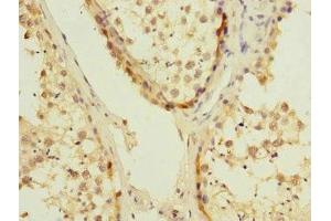 Immunohistochemistry of paraffin-embedded human testis tissue using ABIN7174484 at dilution of 1:100 (UBE2S 抗体  (AA 1-222))