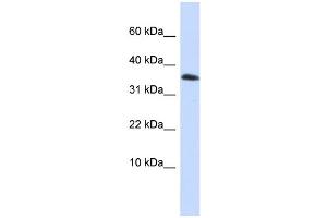 WB Suggested Anti-EMX1 Antibody Titration:  0. (EMX1 抗体  (Middle Region))