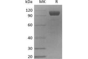 Western Blotting (WB) image for Angiopoietin 2 (ANGPT2) protein (Fc Tag) (ABIN7320897) (Angiopoietin 2 Protein (ANGPT2) (Fc Tag))