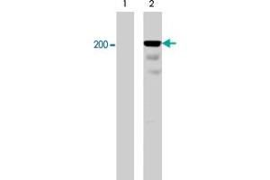 Western blot analysis of A-431 cells serum starved overnight (lane 1) and treated with pervanadate (1mM) for 30 min (lane 2). (Integrin beta 4 抗体  (pTyr1526))