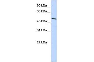 WB Suggested Anti-HOXB3 Antibody Titration: 0. (HOXB3 抗体  (N-Term))