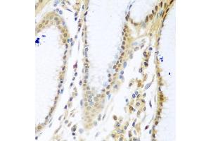 Immunohistochemistry of paraffin-embedded human stomach using MYBBP1A antibody (ABIN5972490) at dilution of 1/100 (40x lens). (MYBBP1A 抗体)