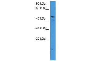 WB Suggested Anti-ZNF713 Antibody Titration: 0. (ZNF713 抗体  (N-Term))