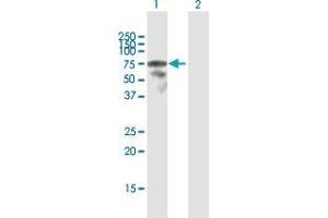 Western Blotting (WB) image for anti-Lymphocyte Cytosolic Protein 2 (SH2 Domain Containing Leukocyte Protein of 76kDa) (LCP2) (AA 1-533) antibody (ABIN2566024)