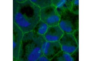 Immunofluorescence of primary RPE cells with ZO1 Ab at 1/100 dilution, (TJP1 抗体  (C-Term))