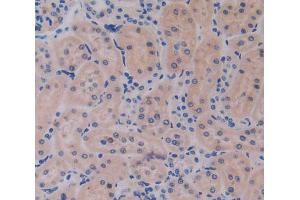Used in DAB staining on fromalin fixed paraffin- embedded kidney tissue (IL17RE 抗体  (AA 457-626))