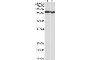 Western Blotting (WB) image for anti-Protein Kinase C, beta (PRKCB) antibody (ABIN5874106) (PKC beta 抗体)