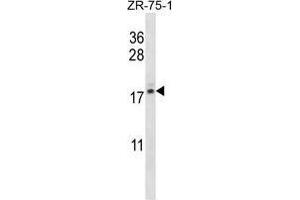 TNP2 Antibody (C-term) western blot analysis in ZR-75-1 cell line lysates (35 µg/lane). (TNP2 抗体  (C-Term))