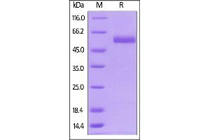 SDS-PAGE (SDS) image for CD4 (CD4) (AA 26-396) (Active) protein (His tag,AVI tag,Biotin) (ABIN5674592)