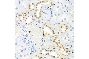 Immunohistochemistry of paraffin-embedded rat kidney using THOC1 antibody. (THOC1 抗体  (AA 428-657))