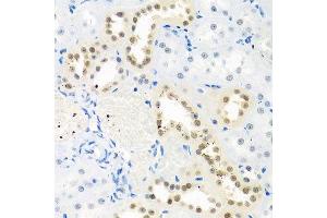 Immunohistochemistry of paraffin-embedded rat kidney using THOC1 antibody. (THOC1 抗体  (AA 428-657))