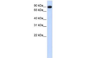 POSTN antibody used at 1 ug/ml to detect target protein. (Periostin 抗体  (Middle Region))