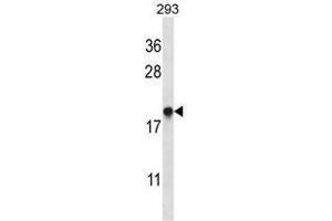 TMM85 Antibody (N-term) western blot analysis in 293 cell line lysates (35 µg/lane). (EMC4 抗体  (N-Term))