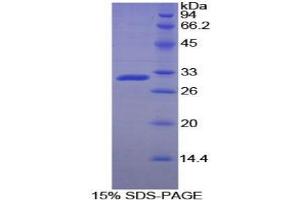 SDS-PAGE analysis of Rat ACP5 Protein. (ACP5 蛋白)