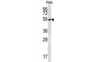 Western Blotting (WB) image for anti-tRNA Methyltransferase 11 Homolog (Trmt11) antibody (ABIN3002328) (Trmt11 抗体)