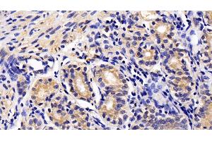 Detection of JAK3 in Human Stomach Tissue using Polyclonal Antibody to Janus Kinase 3 (JAK3)