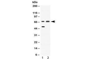 Western blot testing of 1) rat liver and 2) HeLa lysate with ACADVL antibody at 0. (ACADVL 抗体  (AA 538-576))