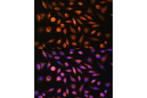 Immunofluorescence analysis of L929 cells using SH3PXD2A Rabbit pAb (ABIN6135104, ABIN6147731 and ABIN7101844) at dilution of 1:100. (SH3PXD2A 抗体)