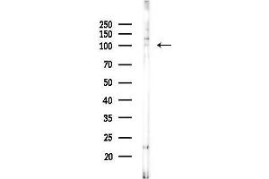 anti-Trafficking Protein, Kinesin Binding 2 (TRAK2) (C-Term) antibody