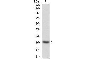 Western blot analysis using JAK2 mAb against human JAK2(AA: 745-955) recombinant protein. (JAK2 抗体  (AA 745-955))